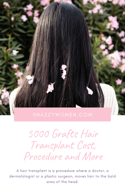 5000 Grafts Hair Transplant Cost, Procedure and More
